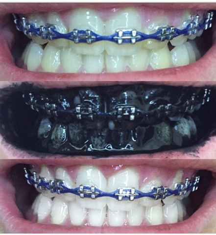 Teeth Whitening Charcoal kit with Bamboo Brush